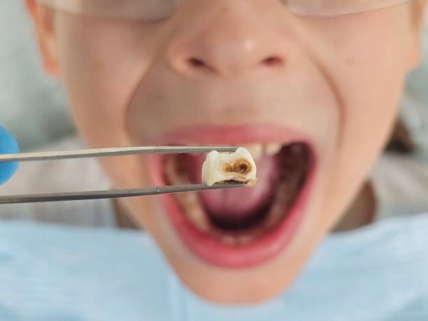 Best Emergency Dental Services Near Me  in Andrews, IN